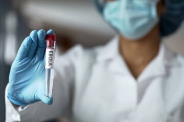 कंगोमा घातक भाइरसको प्रकोपबाट ६५ जनाको मृत्यु